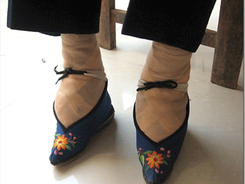 ''BU ÜLKEDEKİ KADINLAR GÜZELLİK UĞRUNA AYAKLARINI KIRDIRIYOR!'' 12