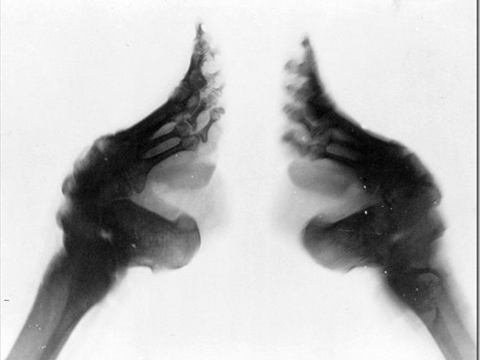 ''BU ÜLKEDEKİ KADINLAR GÜZELLİK UĞRUNA AYAKLARINI KIRDIRIYOR!'' 13