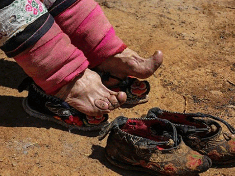 ''BU ÜLKEDEKİ KADINLAR GÜZELLİK UĞRUNA AYAKLARINI KIRDIRIYOR!'' 8