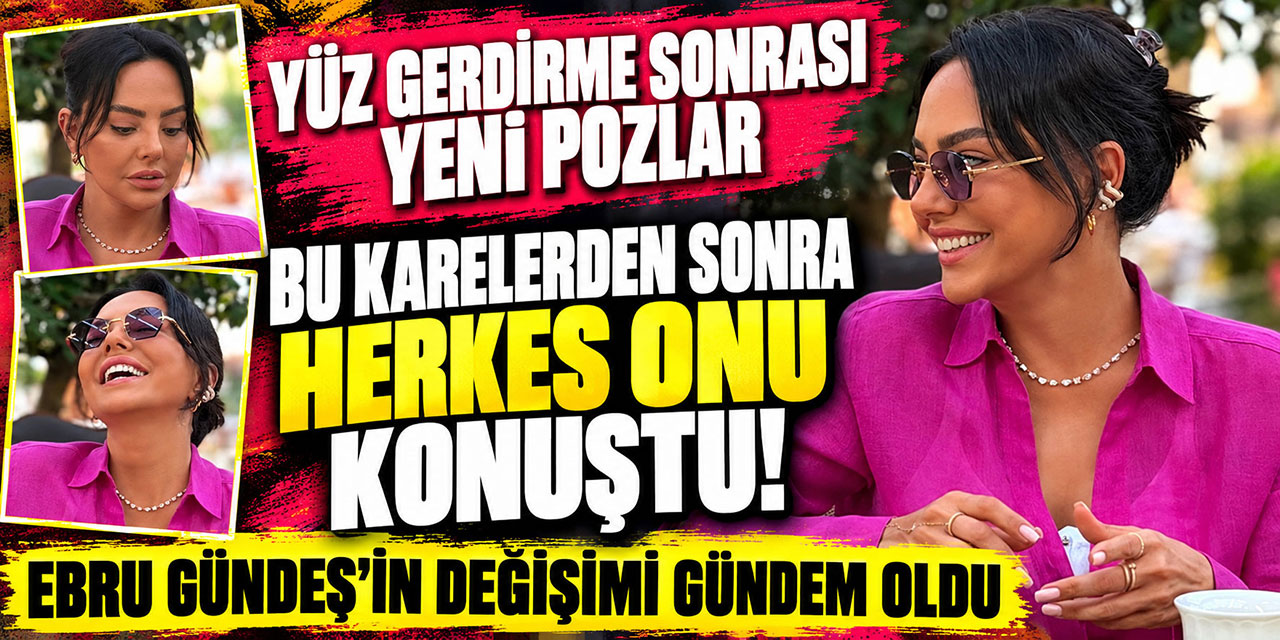 Ebru Gündeş… YÜZÜNÜ GERDİRMİŞTİ! 'SON POZ'LARI ŞAŞIRTTI!