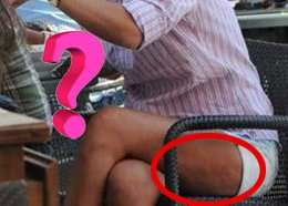 BACAKLARI PORTAKAL KABUĞU GİBİ OLAN ŞARKICI KİM?