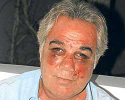 Faruk Tınaz... DEHŞET DAKİKALARINI ANLATTI!