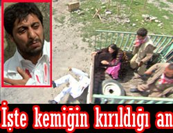 KAMYONDAN DÜŞEN DİZİ OYUNCUSUNUN KOLU KIRILDI AMA ROLÜNE DEVAM ETTİ!