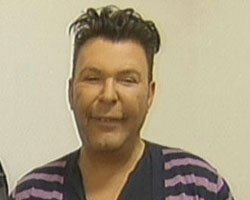 Kuşum Aydın... YÜZÜ BU HALE NASIL GELDİ?