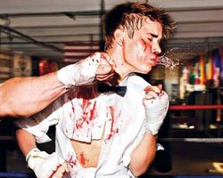 Justin Bieber...DAYAK YEDİ, AĞZINI BURNUNU KIRDILAR!..