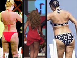 3-2-1? SELÜLİT SEZONU AÇILDI!...