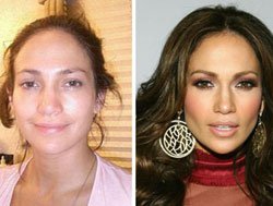 ÜNLÜLER KUSURSUZ MU, YOKSA ESTETİKLİ Mİ?