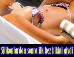 SİLİKONLU GÖĞÜSLERİNİ İLK KEZ SERGİLEDİ!