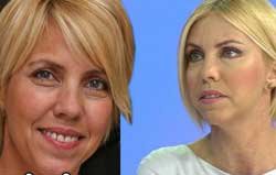 Deniz Pulaş... YORGUN GÖRÜNTÜDEN ESTETİKLE KURTULDU!