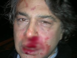 Barbaros Şansal... TEKBİR SESLERİYLE SALDIRIYA UĞRADI...