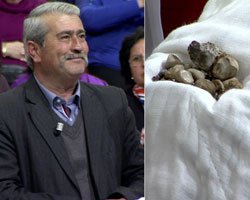 'Doktorum... BÖBREĞİNDEN 510 TANE TAŞ ÇIKTI!