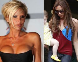 Victoria Beckham... GÖĞÜS SİLİKONLARINI ÇIKARTTI!