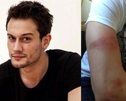 Burak Serdar Şanal... SETTE GÖRÜNMEZ KAZA!