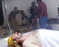 Burçin Bildik... SETTE ASİTTEN YANDI!