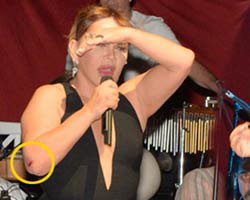 Sezen Aksu düşterek yaralandı... YORGUNLUK MU, NAZAR MI?