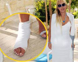 Ahu Tuğba... ŞANSSIZLIĞI DEVAM EDİYOR, AYAĞINI KIRDI!