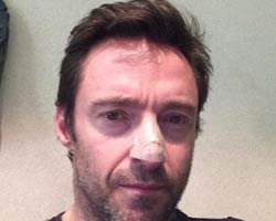 Hugh Jackman... CİLT KANSERİNE YAKALANDI!