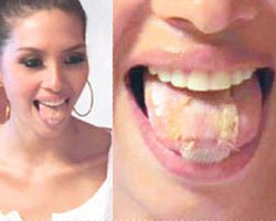 TESCİLLİ GÜZELİN ŞOK EDEN ZAYIFLAMA YÖNTEMİ!