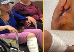 Yeliz Yeşilmen... GÖRÜNMEZ KAZA, BACAKLARI PARÇALANDI!