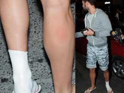 Murat Boz... HALI SAHADA SAKATLANDI!