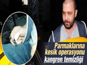 Nejat İşler... PARMAKLARINA CERRAHİ MÜHADALE!