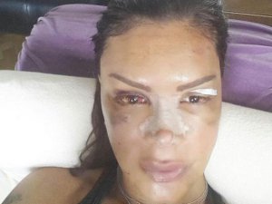 Sevda Demirel... YÜZÜ YENİDEN YAPILDI!