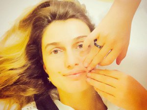 Tuğba Özay... YÜZ FELCİNE MASAJLI TEDAVİ