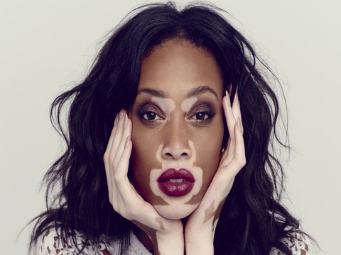 Chantelle Winnie... SIRA DIŞI TOP MODEL, ANKARA TERÖRÜNÜ LANETLEDİ !..