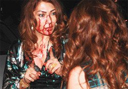 Gülşah Dilek... KAFASINDA ŞİŞE KIRILDI!