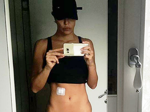 Deniz Akkaya... KARNINA DEMİR SAPLANDI!