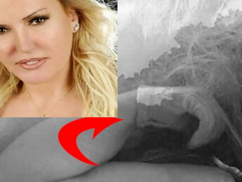 Filiz Aker... SAĞ ELİNDEKİ ELDİVENİN GİZEMİ ÇÖZÜLEMEDİ!..