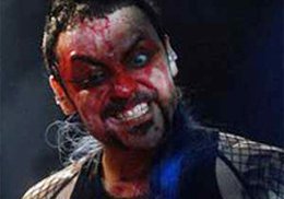 SAHNEDE KANLAR İÇİNDE KALDI!..