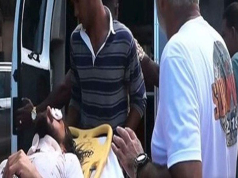 Hakan Hatipoğlu... SURVİVOR 2018'DE ŞOK SAKATLIK!