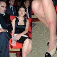 Nurgül Yeşilçay... ÖDÜL TÖRENİNDE MERDİVENDEN DÜŞTÜ!