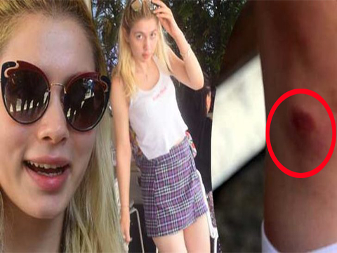 Aleyna Tilki... KERTENKELEDEN KAÇTI; MERDİVENDEN DÜŞTÜ!