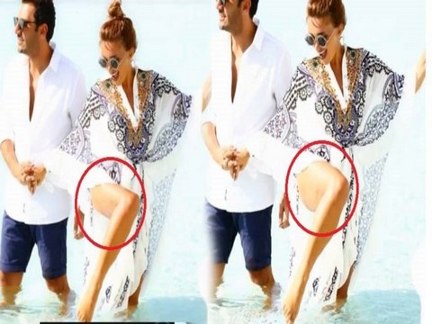 Seren Serengil... SELÜLİT ŞİKAYETİNE RET!..