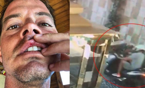 Alp Kırşan... GÖRÜNMEZ KAZA!