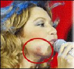 Hadise... YOĞUN TEMPOYA DAYANAMADI, BAĞIŞIKLIK SİSTEMİ ÇÖKTÜ!