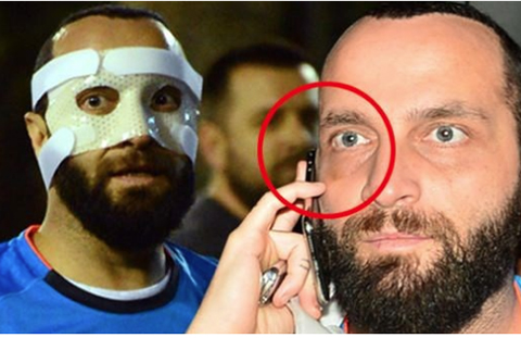Berkay... MASKE TAKIYOR!