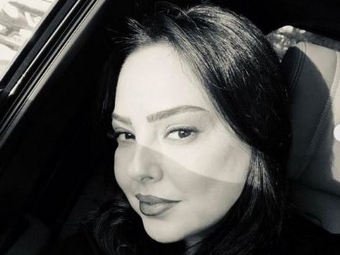 Ebru Gündeş... KÖFTE DUDAK MODASINA O DA UYDU!..