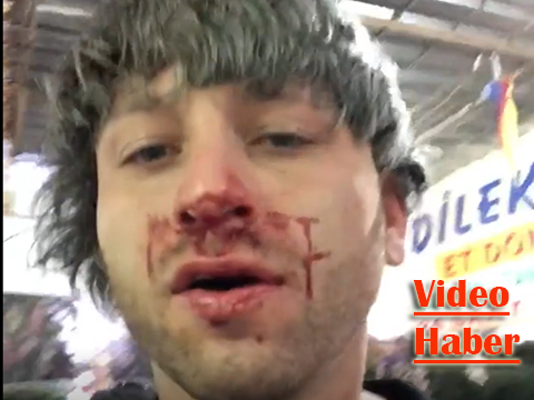 Medyada ilk haber / Survivor Taner… 20 KİŞİNİN SALDIRISINA UĞRADI!