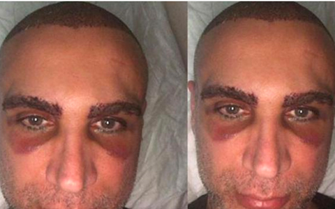 Doğuş... BU GÖRÜNTÜ SEVENLERİNİ ENDİŞELENDİRDİ!