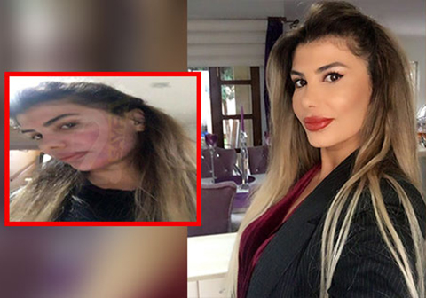 Hatice... YÜZÜNE NE OLDU?