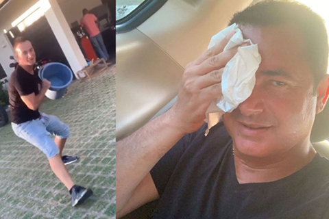 Acun Ilıcalı...SULU ŞAKA KURBANI OLDU, YARALANDI!