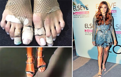 Magazinkolik Özel / Hande Erçel...HİÇ BİR ŞEYDEN ÇEKMEDİ, AYAKLARINDAN ÇEKTİĞİ KADAR!