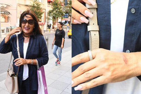 Nükhet Duru...GÖRÜNMEZ KAZA!