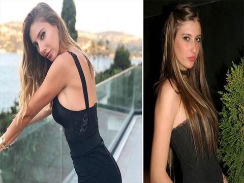 Şeyma Subaşı...ESTETİK İDDİALARINA İLK KEZ YANIT VERDİ!