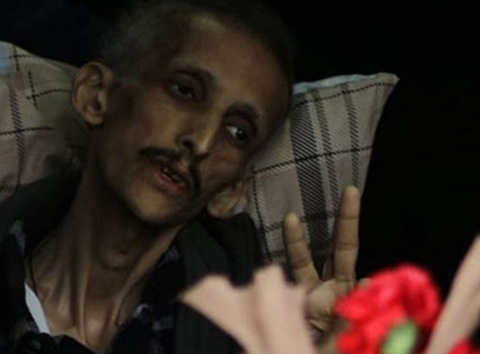 Grup Yorum üyesi İbrahim Gökçek... ÖLÜM  ORUCUNU BİTİRMİŞTİ, KURTARILAMADI!