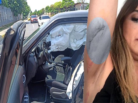 Zeynep Tandoğan... EMNİYET KEMERİ HAYATINI KURTARDI!