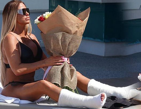 Katie Price... TATİLİ ZEHİR OLDU, İKİ AYAĞI DA ALÇIDA!